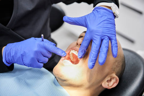 Best Emergency Treatment for Dental Infections or Abscesses in Bridgeport, WV